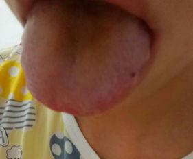 喉咙发炎吃瓜,吃瓜也能缓解？揭秘瓜类食物的神奇功效